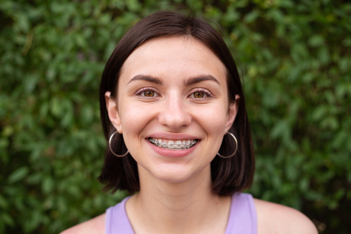 Braces for Teens